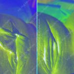 best labiaplasty effects you have ever seen case #1887 photo1