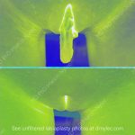 Labiaplasty before and after photo case #2122 photo2