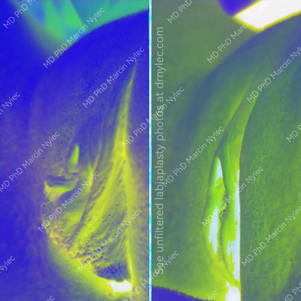 patient from london effect of surgery case #2176 photo1
